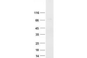 NCOA4 Protein (Transcript Variant 5) (Myc-DYKDDDDK Tag)