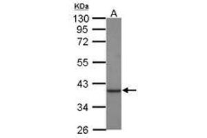 Image no. 1 for anti-Creatine Kinase, Mitochondrial 1B (CKMT1B) (AA 212-388) antibody (ABIN1497529) (CKMT1B antibody  (AA 212-388))