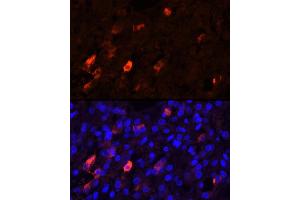 Immunofluorescence analysis of Human adrenal gland cells using PENK Rabbit pAb (ABIN6133151, ABIN6145444, ABIN6145445 and ABIN6221906) at dilution of 1:25 (40x lens). (Enkephalin antibody  (AA 25-267))