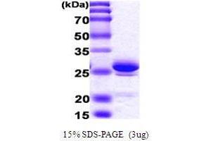 Figure annotation denotes ug of protein loaded and % gel used. (HMGB1 Protein (AA 1-215))
