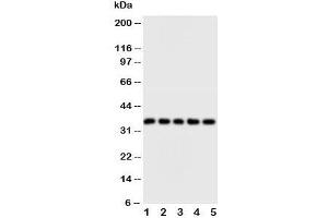 Western blot testing of FosB antibody and Lane 1:  HT1080;  2: SW620;  3: HeLa;  4: SMMC-7721;  5: MM453 cell lysate