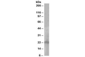Western blot testing of A431 lysate with PALLID antibody at 1ug/ml. (Pallidin antibody)
