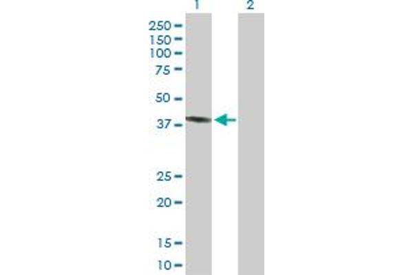 PECI/ECI2 antibody  (AA 1-364)