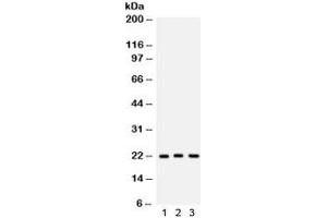 Western blot testing of 1) human A549, 2) rat brain and 3) mouse brain lysate with Peroxiredoxin 5 antibody. (Peroxiredoxin 5 antibody  (AA 66-198))
