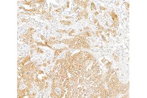 Immunohistochemistry (IHC) image for anti-phosphoglycerate Dehydrogenase (PHGDH) (AA 1-50) antibody (ABIN7455052)