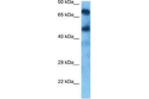 Host:  Rabbit  Target Name:  KCND3  Sample Tissue:  Liver Tumor lysates  Antibody Dilution:  1ug/ml (KCND3 antibody  (C-Term))