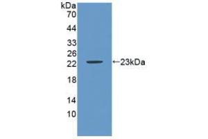 Western blot analysis of recombinant Mouse CA9.