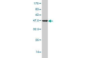 Western Blot detection against Immunogen (42. (SAP18 antibody  (AA 1-153))