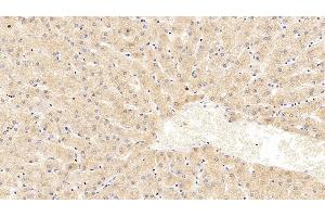 Detection of Hsp60 in Human Liver Tissue using Monoclonal Antibody to Heat Shock Protein 60 (Hsp60) (HSPD1 antibody  (AA 1-573))