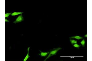 Immunofluorescence of purified MaxPab antibody to SNF8 on HeLa cell. (SNF8 antibody  (AA 1-258))