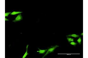 Immunofluorescence of purified MaxPab antibody to SNF8 on HeLa cell.