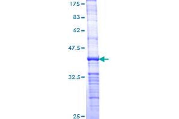 NEK7 Protein (NEK7) (AA 1-100) (GST tag)