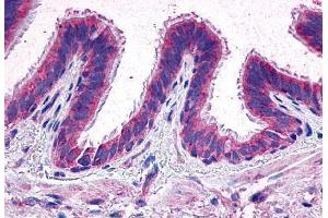 Anti-EP2 antibody  ABIN1048569 IHC staining of human lung. (PTGER2 antibody  (Extracellular Domain))