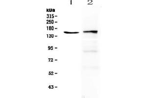 Western blot analysis of PLCG 2 using anti-PLCG 2 antibody .