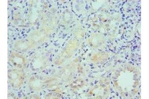 Immunohistochemistry of paraffin-embedded human kidney tissue using ABIN7158577 at dilution of 1:100 (LRP6 antibody  (AA 20-150))