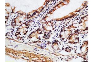 Formalin-fixed and paraffin embedded mouse small intestine labeled with Anti-DHDH Polyclonal Antibody, Unconjugated  at 1:200 followed by conjugation to the secondary antibody and DAB staining. (DHDH antibody  (AA 281-334))