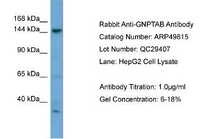WB Suggested Anti-GNPTAB  Antibody Titration: 0. (GNPTAB antibody  (N-Term))