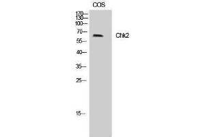 Western Blotting (WB) image for anti-Checkpoint Kinase 2 (CHEK2) (Tyr599) antibody (ABIN3179951) (CHEK2 antibody  (Tyr599))