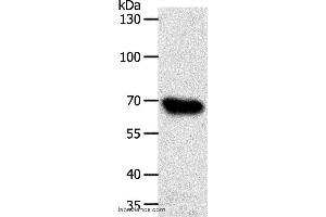 Western blot analysis of HT-29 cell, using ABCG1 Polyclonal Antibody at dilution of 1:500 (ABCG1 antibody)