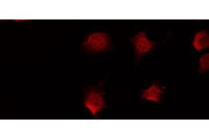 ABIN6266840 staining Hela by IF/ICC. (FKRP antibody  (N-Term))