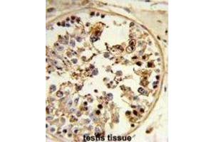 Immunohistochemistry (IHC) image for anti-Alveolar Soft Part Sarcoma Chromosome Region, Candidate 1 (ASPSCR1) antibody (ABIN3003927) (ASPSCR1 antibody)