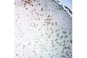 Anti-Muscarinic Acetylcholine Receptor 2 antibody,  IHC(P) IHC(P): Rat Brain Tissue