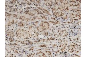 Image no. 1 for anti-Damage Specific DNA Binding Protein 1 (DDB1) (AA 1044-1141) antibody (ABIN599367) (DDB1 antibody  (AA 1044-1141))