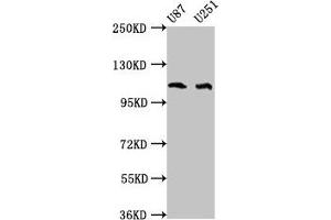 Western Blot Positive WB detected in: U87 whole cell lysate, U251 whole cell lysate All lanes: ABL2 antibody at 4 μg/mL Secondary Goat polyclonal to rabbit IgG at 1/50000 dilution Predicted band size: 129, 125, 127, 115, 118, 116, 117, 61 kDa Observed band size: 115 kDa (ABL2 antibody  (AA 862-1064))