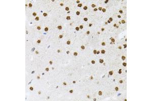 Immunohistochemistry of paraffin-embedded mouse brain using FAF1 antibody (ABIN5975642) (40x lens). (FAF1 antibody)