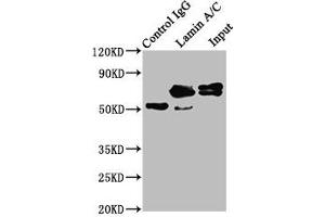 Immunoprecipitating Lamin A/C in Hela whole cell lysate Lane 1: Rabbit control IgG instead of ABIN7127601 in Hela whole cell lysate.