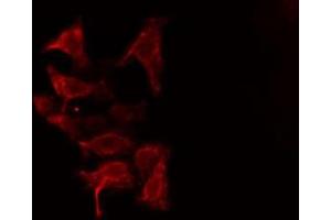 ABIN6275868 staining HuvEc cells by IF/ICC. (CD90 antibody  (Internal Region))