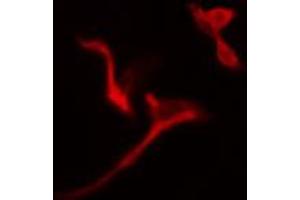 ABIN6274785 staining A549 cells by IF/ICC. (PGD antibody  (C-Term))