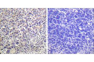 Peptide - +Immunohistochemistry analysis of paraffin-embedded human thyroid gland tissue using HBP1 antibody. (HBP1 antibody)