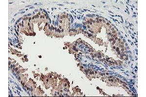 Immunohistochemical staining of paraffin-embedded Human prostate tissue using anti-ACSS2 mouse monoclonal antibody.