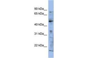 Image no. 1 for anti-RAB3A Interacting Protein (Rabin3) (RAB3IP) (AA 107-156) antibody (ABIN6743739)