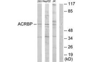 Western Blotting (WB) image for anti-Acrosin Binding Protein (ACRBP) (AA 181-230) antibody (ABIN2889677) (ACRBP antibody  (AA 181-230))