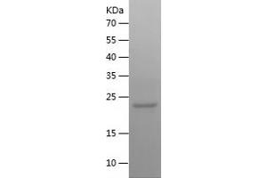 Western Blotting (WB) image for GTPase NRas (NRAS) (AA 1-186) protein (His tag) (ABIN7283264) (GTPase NRas Protein (NRAS) (AA 1-186) (His tag))