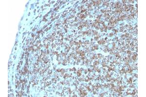 Formalin-fixed, paraffin-embedded human Tonsil stained with CD74 Recombinant Rabbit Monoclonal Antibody (CLIP/3127R). (Recombinant CD74 antibody)