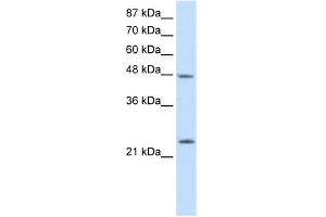 WB Suggested Anti-CBX6 Antibody Titration:  2. (CBX6 antibody  (N-Term))