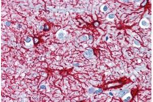 Human Brain, Cortex (formalin-fixed, paraffin-embedded) stained with GFAP antibody ABIN351523 at 1-2 ug/ml followed by biotinylated anti-mouse IgG secondary antibody ABIN481714, alkaline phosphatase-streptavidin and chromogen.
