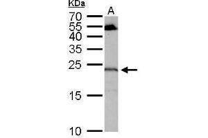 WB Image RGS4 antibody detects RGS4 protein by Western blot analysis. (RGS4 antibody)