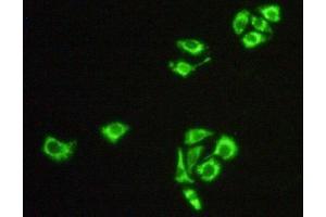 Detection of Hsp60 in Hela cells using Polyclonal Antibody to Heat Shock Protein 60 (Hsp60) (HSPD1 antibody  (AA 316-573))
