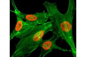 ICC/IF staining of HeLa cells treated with sodium butyrate using recombinant H2A. (Recombinant H2AFZ antibody  (acLys4))