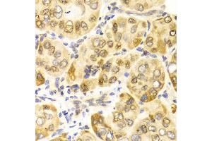 Immunohistochemistry (IHC) image for anti-Carnitine Palmitoyltransferase 2 (CPT2) antibody (ABIN3023425) (CPT2 antibody)