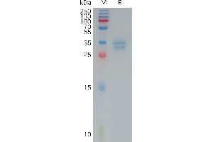 Human C(144-156) Protein, hFc Tag on SDS-PAGE under reducing condition. (Claudin 3 Protein (CLDN3) (AA 144-156) (Fc Tag))