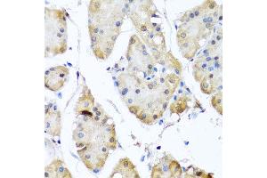 Immunohistochemistry of paraffin-embedded human gastric using YAP1 antibody at dilution of 1:100 (x40 lens).