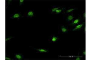 Immunofluorescence of monoclonal antibody to HNF4A on HeLa cell. (HNF4A antibody  (AA 324-423))
