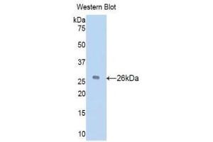 Western Blotting (WB) image for anti-Vitamin D-Binding Protein (GC) (AA 205-403) antibody (ABIN1078667)