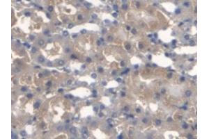 Detection of TMEM27 in Mouse Kidney Tissue using Monoclonal Antibody to Transmembrane Protein 27 (TMEM27) (TMEM27 antibody  (AA 12-222))