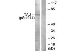 Western blot analysis of extracts from HeLa cells, using Tau (Phospho-Ser214) Antibody. (tau antibody  (pSer531))